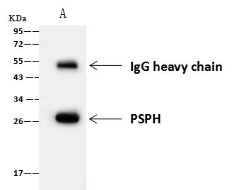 PSPH Antibody - PSPH was immunoprecipitated using: Lane A: 0.5 mg K-562 Whole Cell Lysate. 4 uL anti-PSPH rabbit polyclonal antibody and 60 ug of Immunomagnetic beads Protein A/G. Primary antibody: Anti-PSPH rabbit polyclonal antibody, at 1:100 dilution. Secondary antibody: Goat Anti-Rabbit IgG (H+L)/HRP at 1/10000 dilution. Developed using the ECL technique. Performed under reducing conditions. Predicted band size: 25 kDa. Observed band size: 26 kDa.