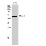 PSPLA1 / Phospholipase A1 Antibody - Western blot of PLA1A antibody