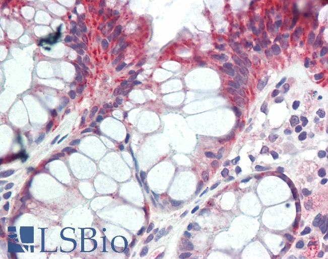 PSPLA1 / Phospholipase A1 Antibody - Anti-PSPLA1 / PLA1A antibody IHC staining of human colon. Immunohistochemistry of formalin-fixed, paraffin-embedded tissue after heat-induced antigen retrieval. Antibody concentration 10 ug/ml.  This image was taken for the unconjugated form of this product. Other forms have not been tested.