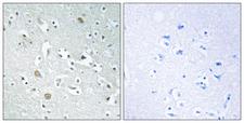 PSPLA1 / Phospholipase A1 Antibody - Immunohistochemistry analysis of paraffin-embedded human brain, using PLA1A Antibody. The picture on the right is blocked with the synthesized peptide.