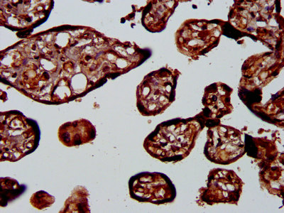 PSPLA1 / Phospholipase A1 Antibody - Immunohistochemistry image at a dilution of 1:400 and staining in paraffin-embedded human placenta tissue performed on a Leica BondTM system. After dewaxing and hydration, antigen retrieval was mediated by high pressure in a citrate buffer (pH 6.0) . Section was blocked with 10% normal goat serum 30min at RT. Then primary antibody (1% BSA) was incubated at 4 °C overnight. The primary is detected by a biotinylated secondary antibody and visualized using an HRP conjugated SP system.