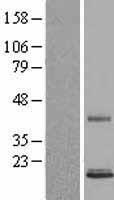 PSPN / Persephin Protein - Western validation with an anti-DDK antibody * L: Control HEK293 lysate R: Over-expression lysate