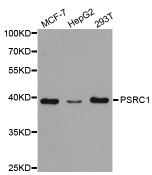 PSRC1 / DDA3 Antibody - Western blot analysis of extracts of various cell lines.