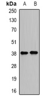 PSRC1 / DDA3 Antibody - Western blot analysis of DDA3 expression in MCF7 (A); HepG2 (B) whole cell lysates.