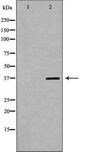 PSRC1 / DDA3 Antibody - Western blot analysis of HeLa whole cells lysates using PSRC1 antibody. The lane on the left is treated with the antigen-specific peptide.
