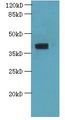 PSTK Antibody - Western blot. All lanes: PSTK antibody at 5 ug/ml+ HeLa whole cell lysate Goat polyclonal to rabbit at 1:10000 dilution. Predicted band size: 40 kDa. Observed band size: 40 kDa.