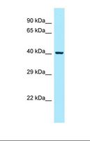 PSTPIP1 Antibody - Western blot of Human NCI-H226. PSTPIP1 antibody dilution 1.0 ug/ml.  This image was taken for the unconjugated form of this product. Other forms have not been tested.