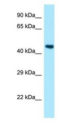 PSTPIP1 Antibody - PSTPIP1 antibody Western Blot of Fetal Liver.  This image was taken for the unconjugated form of this product. Other forms have not been tested.