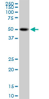 PSTPIP1 Antibody - PSTPIP1 monoclonal antibody (M02), clone 1D5. Western blot of PSTPIP1 expression in Raw 264.7.