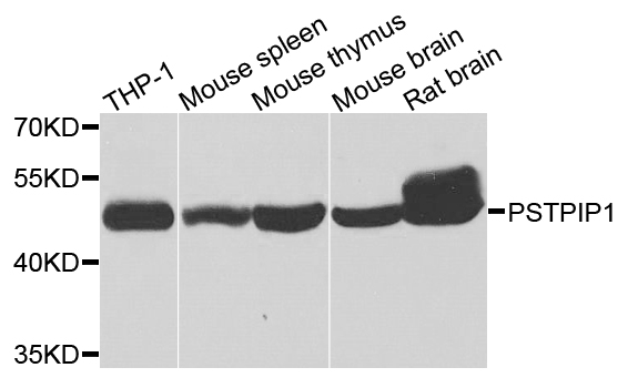 PSTPIP1 Antibody - Western blot analysis of extracts of various cells.