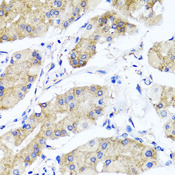 PSTPIP1 Antibody - Immunohistochemistry of paraffin-embedded human stomach tissue.