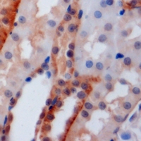 PSTPIP1 Antibody - Immunohistochemical analysis of PSTPIP1 staining in mouse kidney formalin fixed paraffin embedded tissue section. The section was pre-treated using heat mediated antigen retrieval with sodium citrate buffer (pH 6.0). The section was then incubated with the antibody at room temperature and detected using an HRP conjugated compact polymer system. DAB was used as the chromogen. The section was then counterstained with hematoxylin and mounted with DPX.