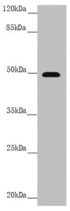 PSTPIP1 Antibody - Western blot All Lanes:PSTPIP1 antibody at 3.99 ug/ml +Raw264.7 whole cell lysate Secondary Goat polyclonal to rabbit IgG at 1/10000 dilution Predicted band size: 48,46 kDa Observed band size: 48 kDa