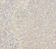PSTPIP1 Antibody - Immunohistochemistry of paraffin-embedded human tonsil tissue at dilution 1:100