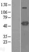 PSTPIP1 Protein - Western validation with an anti-DDK antibody * L: Control HEK293 lysate R: Over-expression lysate