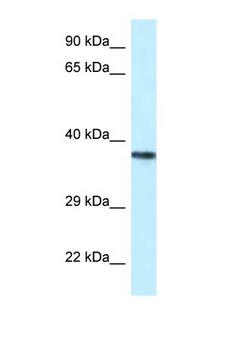 PSTPIP2 Antibody - PSTPIP2 antibody Western blot of Jurkat Cell lysate. Antibody concentration 1 ug/ml.  This image was taken for the unconjugated form of this product. Other forms have not been tested.