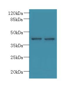PSTPIP2 Antibody - Western blot. All lanes: PSTPIP2 antibody at 6 ug/ml. Lane 1: Raji whole cell lysate. Lane 2: Jurkat whole cell lysate. Secondary Goat polyclonal to Rabbit IgG at 1:10000 dilution. Predicted band size: 39 kDa. Observed band size: 39 kDa.