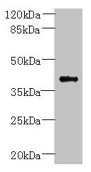 PSTPIP2 Antibody - Western blot All lanes: PSTPIP2 antibody at 6µg/ml + Raji whole cell lysate Secondary Goat polyclonal to rabbit IgG at 1/10000 dilution Predicted band size: 39, 37 kDa Observed band size: 39 kDa