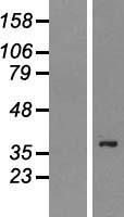 PSTPIP2 Protein - Western validation with an anti-DDK antibody * L: Control HEK293 lysate R: Over-expression lysate