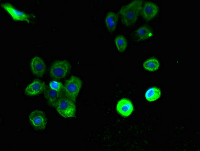 PTAFR / PAF Receptor Antibody - Immunofluorescent analysis of A431 cells using PTAFR Antibody at dilution of 1:100 and Alexa Fluor 488-congugated AffiniPure Goat Anti-Rabbit IgG(H+L)