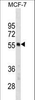 PTBP1 Antibody - PTBP1 Antibody western blot of MCF-7 cell line lysates (35 ug/lane). The PTBP1 antibody detected the PTBP1 protein (arrow).