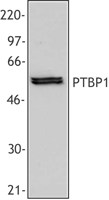 PTBP1 Antibody - Extracts from human PBMC were resolved by electrophoresis, transferred to nitrocellulose, and probed with monoclonal antibody against PTBP1 (clone 3H7). Proteins were visualized using a goat anti-mouse secondary conjugated to HRP and a chemiluminescence detection system.