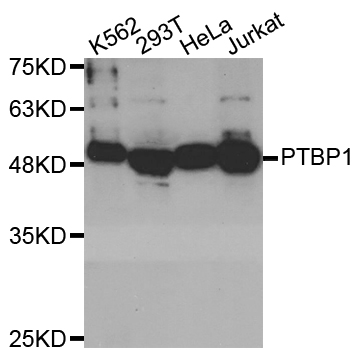 PTBP1 Antibody - Western blot analysis of extracts of various cell lines.