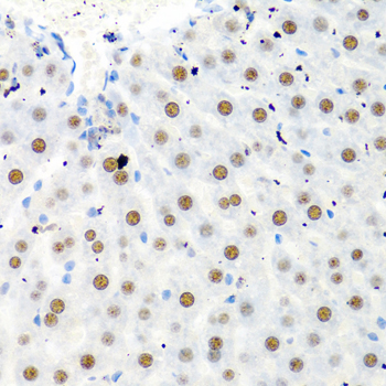 PTBP1 Antibody - Immunohistochemistry of paraffin-embedded rat liver tissue.