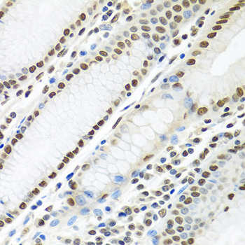 PTBP1 Antibody - Immunohistochemistry of paraffin-embedded human stomach tissue.