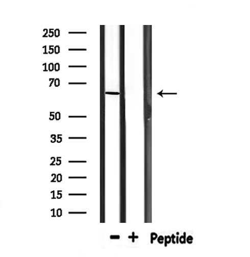 PTBP1 Antibody - Western blot analysis of extracts of mouse spleen using PTBP1 antibody.