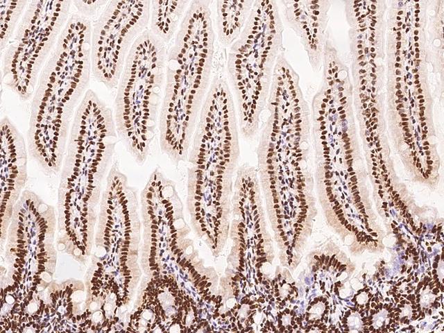 PTBP1 Antibody - Immunochemical staining PTBP1 in mouse small intestine with rabbit polyclonal antibody at 1:2000 dilution, formalin-fixed paraffin embedded sections.