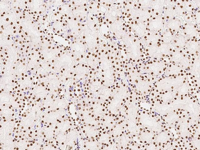 PTBP1 Antibody - Immunochemical staining PTBP1 in rat kidney with rabbit polyclonal antibody at 1:2000 dilution, formalin-fixed paraffin embedded sections.