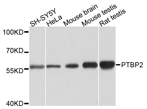 PTBP2 Antibody - Western blot analysis of extracts of various cells.