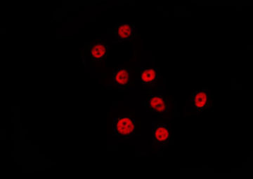 PTBP2 Antibody - Staining HeLa cells by IF/ICC. The samples were fixed with PFA and permeabilized in 0.1% Triton X-100, then blocked in 10% serum for 45 min at 25°C. The primary antibody was diluted at 1:200 and incubated with the sample for 1 hour at 37°C. An Alexa Fluor 594 conjugated goat anti-rabbit IgG (H+L) Ab, diluted at 1/600, was used as the secondary antibody.