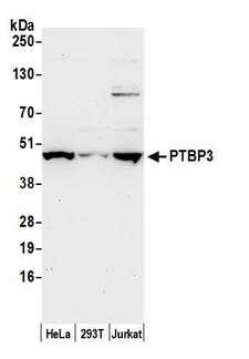 PTBP3 / ROD1 Antibody - Detection of human PTBP3 by western blot. Samples: Whole cell lysate (50 µg) from HeLa, HEK293T, and Jurkat cells prepared using RIPA lysis buffer Antibody: Affinity purified rabbit anti-PTBP3 antibody used for WB at 0.1 µg/ml. Detection: Chemiluminescence with an exposure time of 30 seconds.