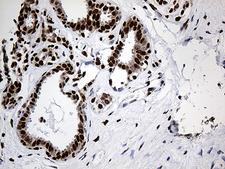 PTBP3 / ROD1 Antibody - Immunohistochemical staining of paraffin-embedded Human breast tissue within the normal limits using anti-PTBP3 mouse monoclonal antibody. (Heat-induced epitope retrieval by 1mM EDTA in 10mM Tris buffer. (pH8.5) at 120°C for 3 min. (1:500)