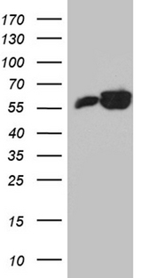 PTBP3 / ROD1 Antibody - HEK293T cells were transfected with the pCMV6-ENTRY control. (Left lane) or pCMV6-ENTRY PTBP3. (Right lane) cDNA for 48 hrs and lysed