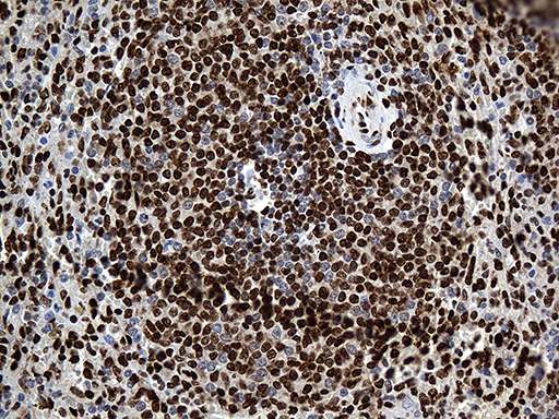 PTBP3 / ROD1 Antibody - Immunohistochemical staining of paraffin-embedded Human spleen tissue within the normal limits using anti-PTBP3 mouse monoclonal antibody. (Heat-induced epitope retrieval by 1mM EDTA in 10mM Tris buffer. (pH8.5) at 120°C for 3 min. (1:500)