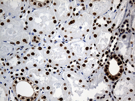PTBP3 / ROD1 Antibody - Immunohistochemical staining of paraffin-embedded Human Kidney tissue within the normal limits using anti-PTBP3 mouse monoclonal antibody. (Heat-induced epitope retrieval by 1mM EDTA in 10mM Tris buffer. (pH8.5) at 120°C for 3 min. (1:500)