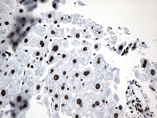 PTBP3 / ROD1 Antibody - Immunohistochemical staining of paraffin-embedded Human liver tissue within the normal limits using anti-PTBP3 mouse monoclonal antibody. (Heat-induced epitope retrieval by 1mM EDTA in 10mM Tris buffer. (pH8.5) at 120°C for 3 min. (1:500)