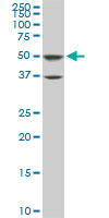 PTBP3 / ROD1 Antibody - ROD1 monoclonal antibody (M01), clone 4C9. Western blot of ROD1 expression in PC-12.