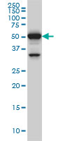 PTBP3 / ROD1 Antibody - ROD1 monoclonal antibody (M01), clone 4C9 Western blot of ROD1 expression in HeLa NE.