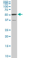 PTBP3 / ROD1 Antibody - ROD1 monoclonal antibody (M01), clone 4C9. Western blot of ROD1 expression in NIH/3T3.