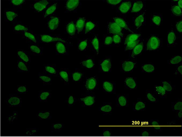 PTBP3 / ROD1 Antibody - Immunofluorescence of monoclonal antibody to ROD1 on HeLa cell (antibody concentration 20 ug/ml).