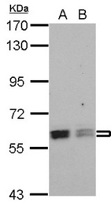 PTBP3 / ROD1 Antibody - Sample (30 ug of whole cell lysate) A: NT2D1 B: PC-3 7.5% SDS PAGE ROD1 antibody diluted at 1:1000