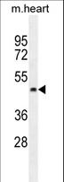 PTCD2 Antibody - PTCD2 Antibody western blot of mouse heart tissue lysates (35 ug/lane). The PTCD2 antibody detected the PTCD2 protein (arrow).