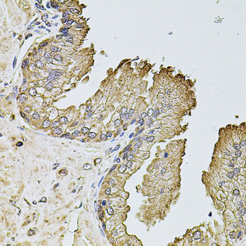 PTCD3 Antibody - Immunohistochemistry of paraffin-embedded human prostate tissue.