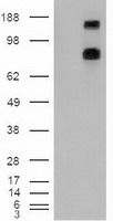 PTCH1 / Patched 1 Antibody - HEK293T cells were transfected with the pCMV6-ENTRY control (Left lane) or pCMV6-ENTRY PTCH1 (Right lane) cDNA for 48 hrs and lysed. Equivalent amounts of cell lysates (5 ug per lane) were separated by SDS-PAGE and immunoblotted with anti-PTCH1.