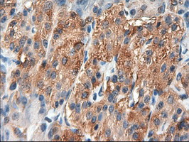 PTCH1 / Patched 1 Antibody - IHC of paraffin-embedded pancreas using anti-PTCH1 mouse monoclonal antibody.