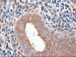 PTCH1 / Patched 1 Antibody - IHC of paraffin-embedded endometrium using anti-PTCH1 mouse monoclonal antibody.